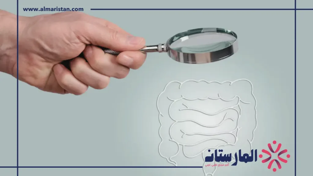 طريقة فحص القولون