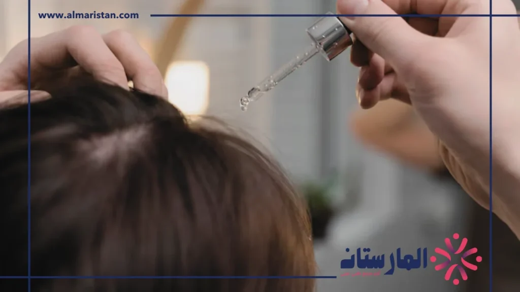 علاج الشعر الخفيف