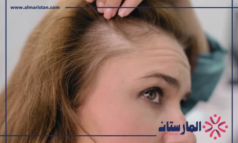 علاج الشعر الخفيف