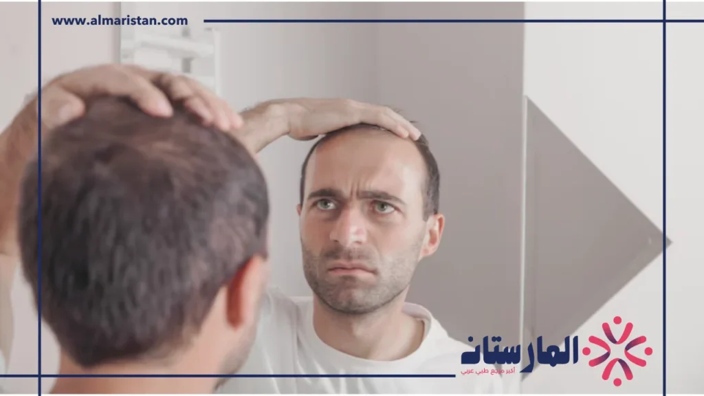 علاج الشعر الخفيف