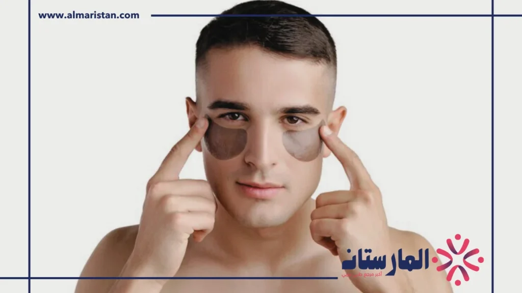 علاج الهالات السوداء تحت العين