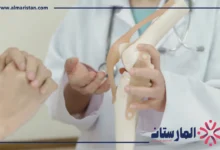 علاج خشونة المفاصل