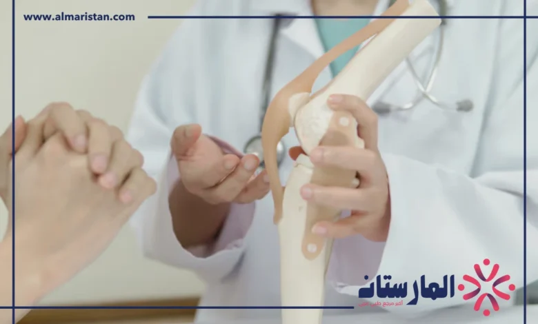 علاج خشونة المفاصل