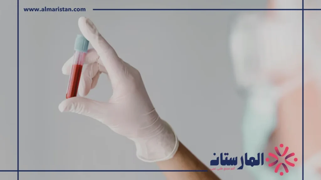 قراءة نتيجة تحليل الدم للحمل hCG