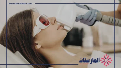 ليزر الوجه