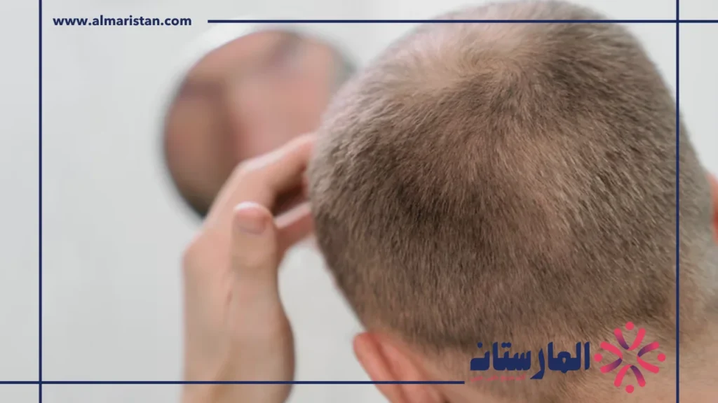 نمو الشعر