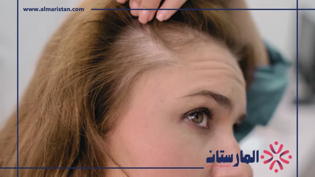 الفرق بين الثعلبه وفراغات الشعر