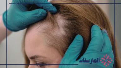 الفرق بين الثعلبه وفراغات الشعر