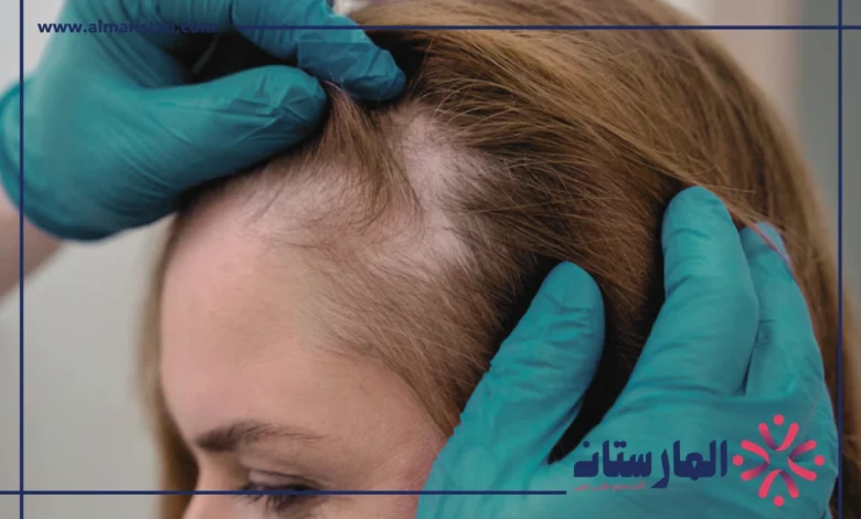 الفرق بين الثعلبه وفراغات الشعر