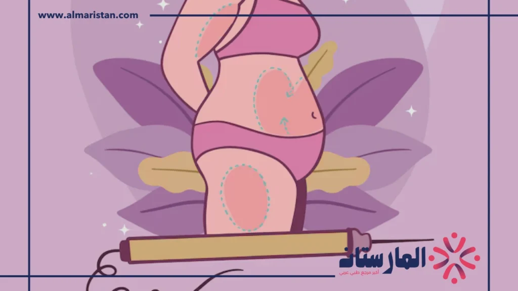 الفيلر للحامل