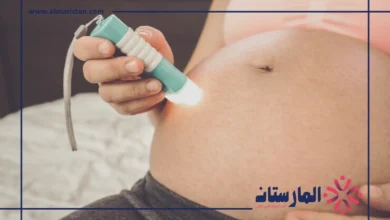 الليزر مضر للحامل