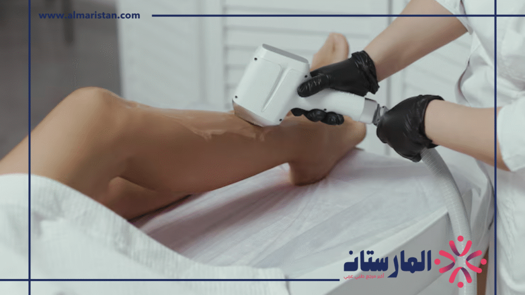ليزر ازالة الشعر