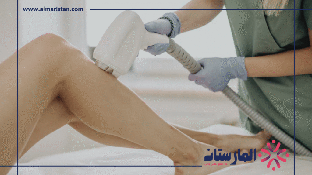 ليزر ازالة الشعر
