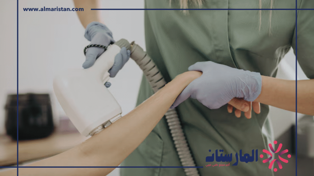 ليزر ازالة الشعر